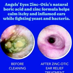 Angel's Eyes Zinc-Otic Ear Relief Treatment for Dogs & Cats, 1-oz