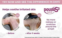 Douxo S3 Calm Mousse (5.1 oz)